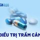 Trầm cảm có mấy giai đoạn phát triển?